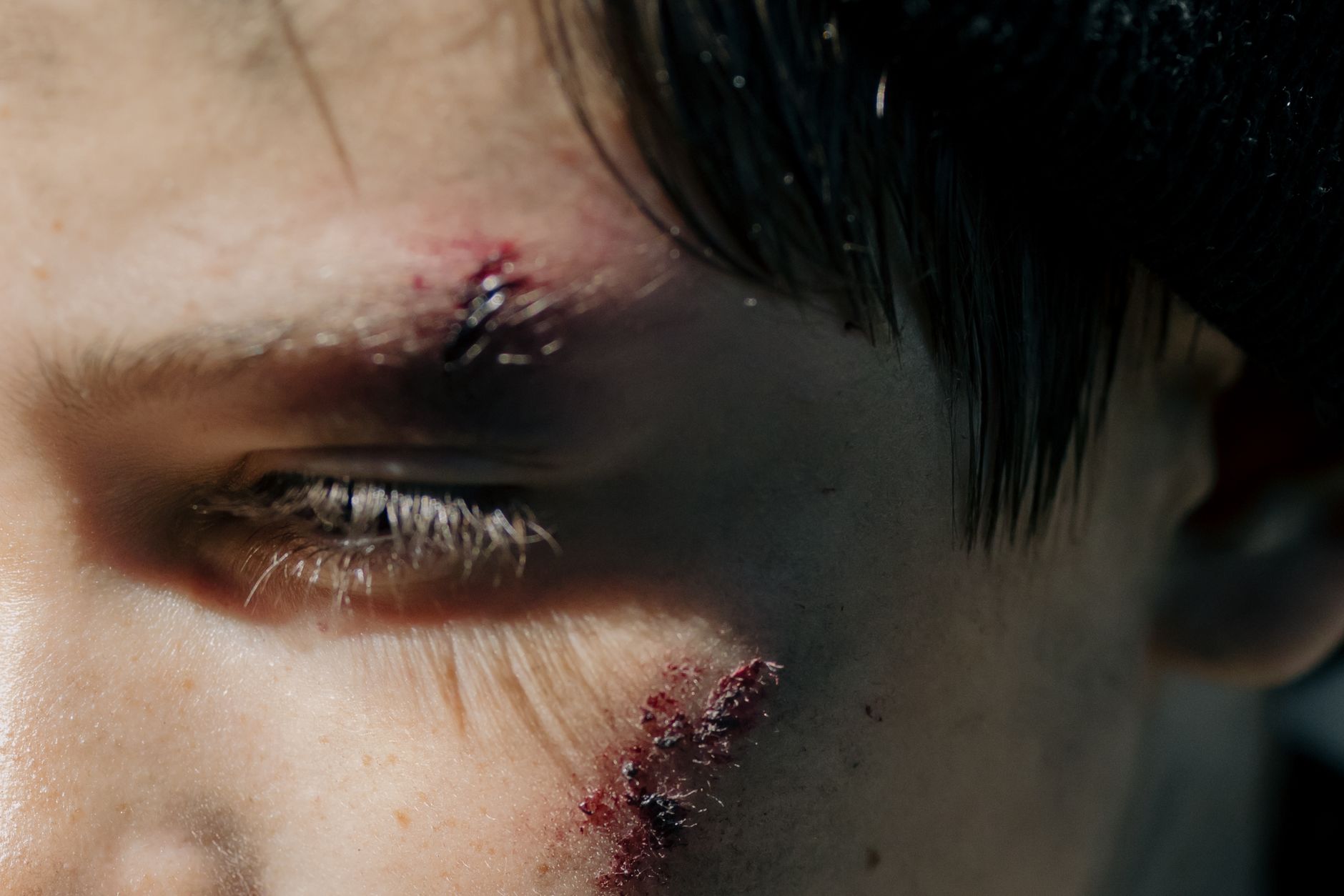 What Happened During the Assault on a Trump Supporter in Escondido?